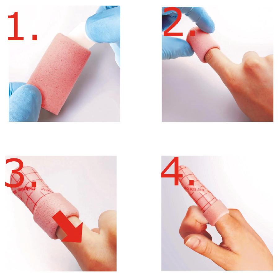 Aplikacja opatrunku PolyMem® Finger/Toe na palec — kolejne kroki